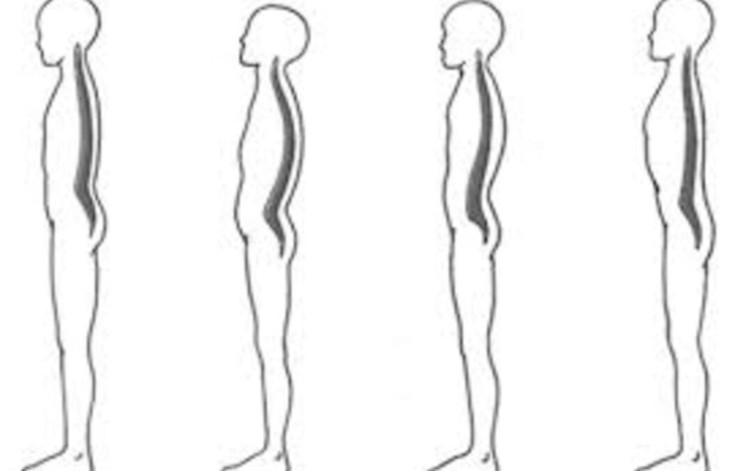 Gerincvédelem a tartáshibák megelőzésére