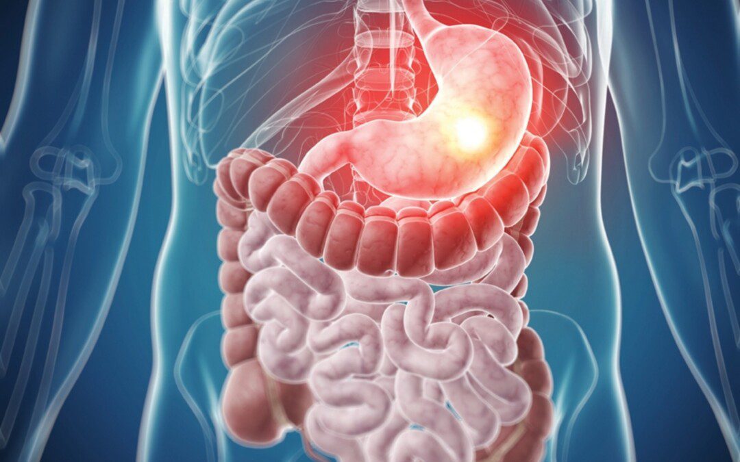 Könnyedén emésztek. Élvezem az étkeket-életet! 1. rész